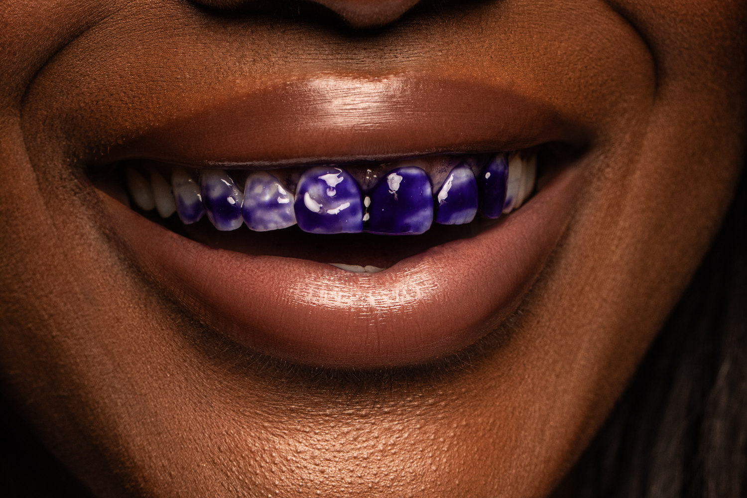 V34 & PAP+ Whitening pen